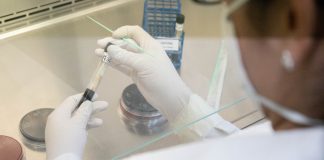 Descarta InDRE caso sospechoso de Viruela del Mono