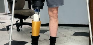 Impulsa Gobierno del Estado fabricación de prótesis innovadoras y accesibles